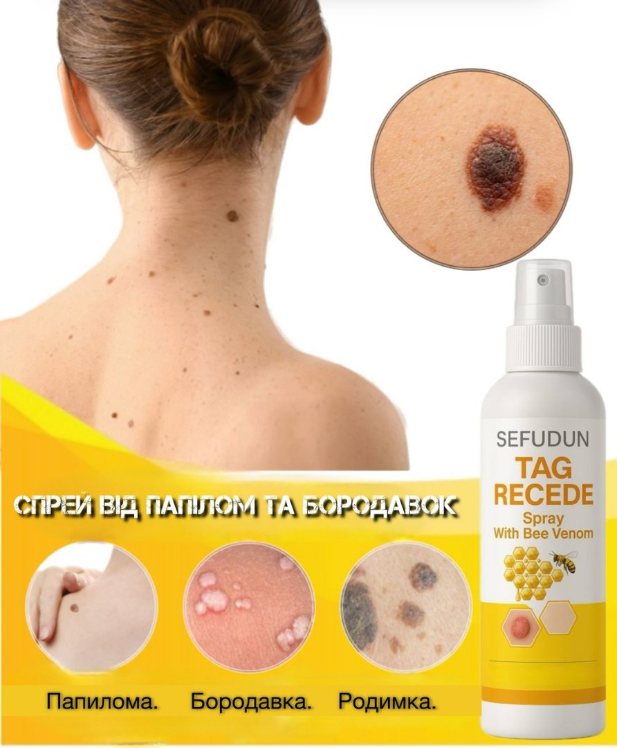 СПРЕЙ ВІД ПАПІЛОМ ТА БОРОДАВОК